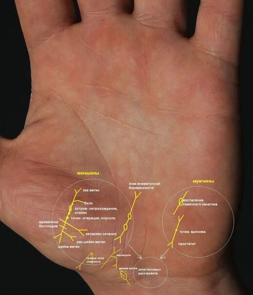 Показать линию жизни на руке фото Атлас болезней. Константин Пилипишин. ХИРОМАНТИЯ. КЛУБ ХИРОМАНТОВ ВКонтакте