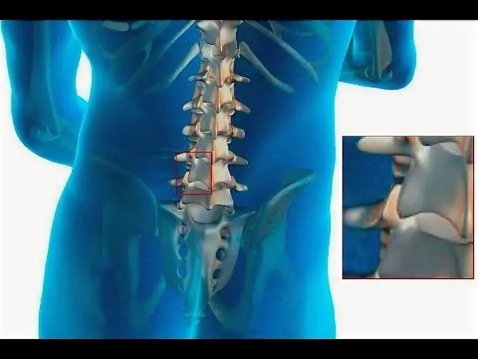 Показать пояснично крестцовый отдел позвоночника фото Lumbar Osteoarthritis Degenerative Arthritis - Health Education Men health tips,