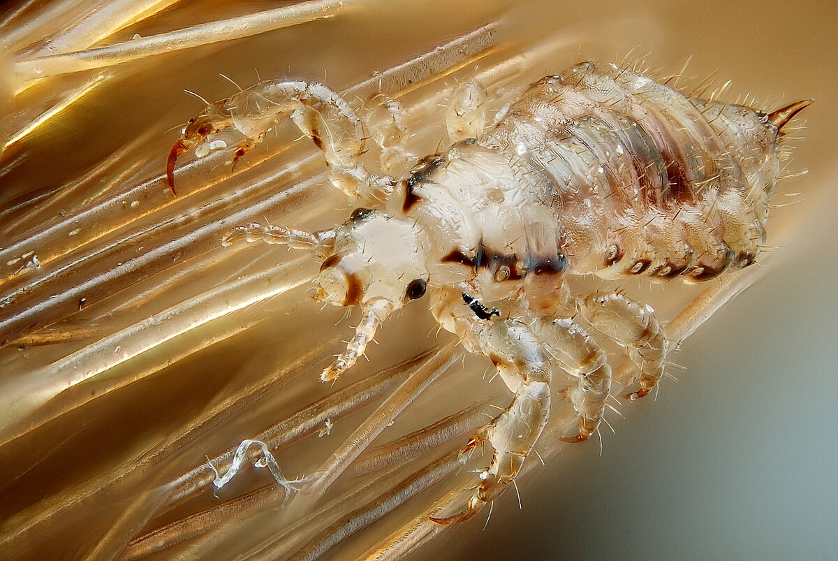 Покажи фотку как выглядят вши Файл:Male human head louse.jpg - Вікіпэдыя