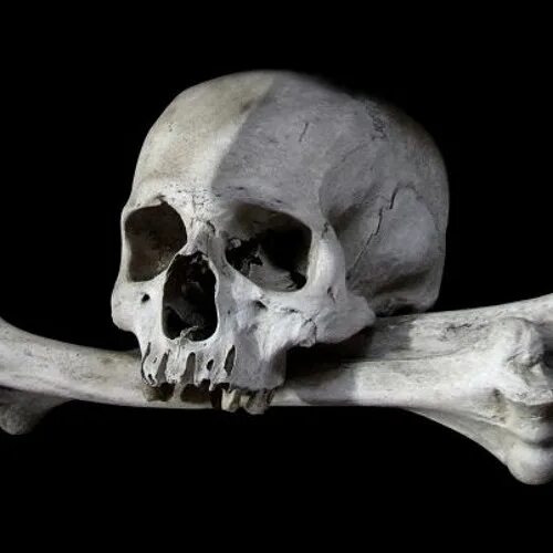 NO LONGER AVAILABLE Human skeleton, Real human skull, Human bones