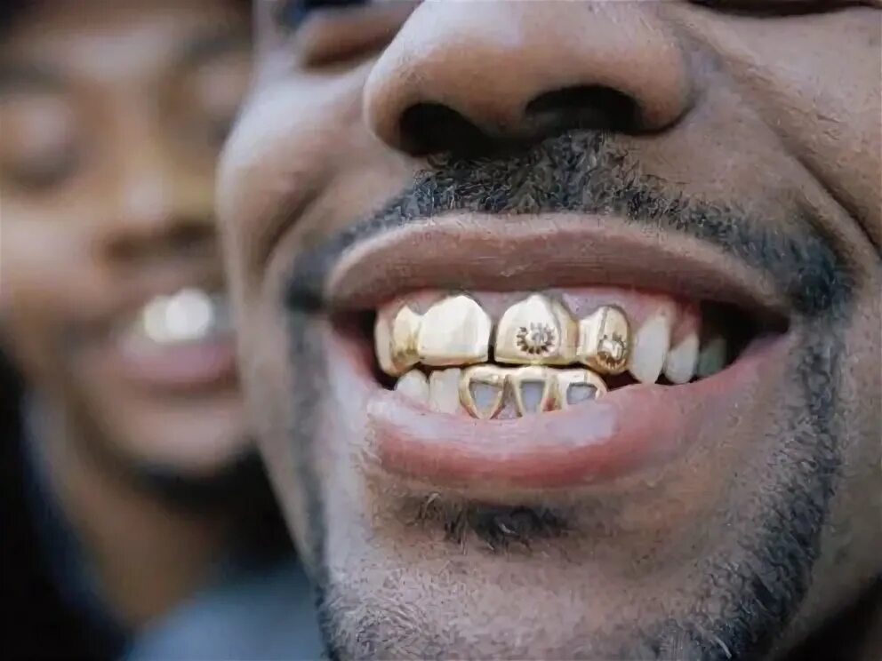 Покажи фото зубов NYC Grill Grillz teeth, Grillz, Gold teeth