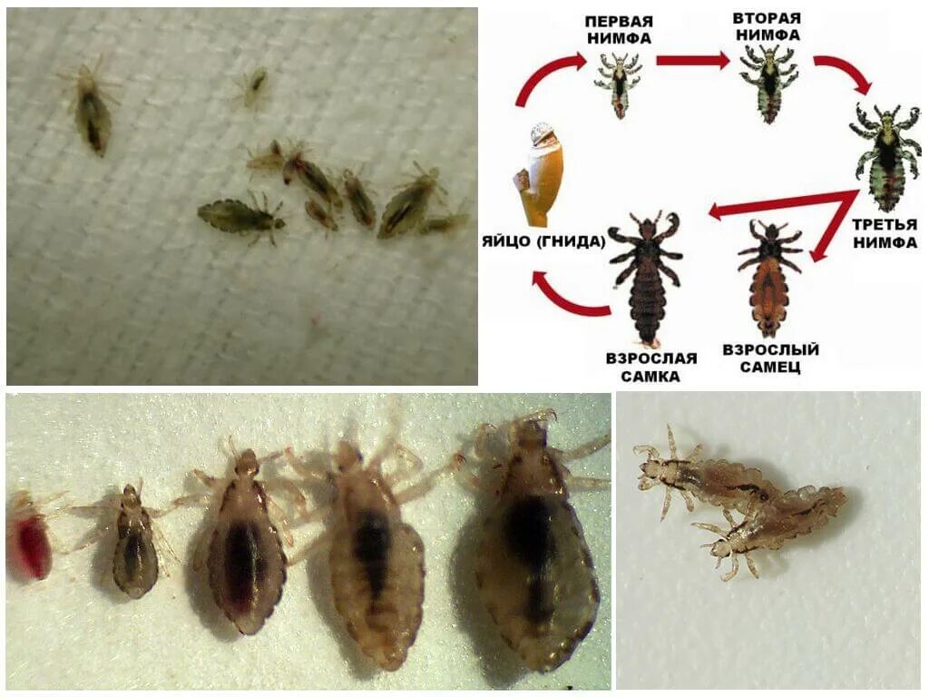 Покажи как выглядят бельевые вши Уничтожение бельевых вшей в квартире в Костроме - Избавиться от платяных (бельев