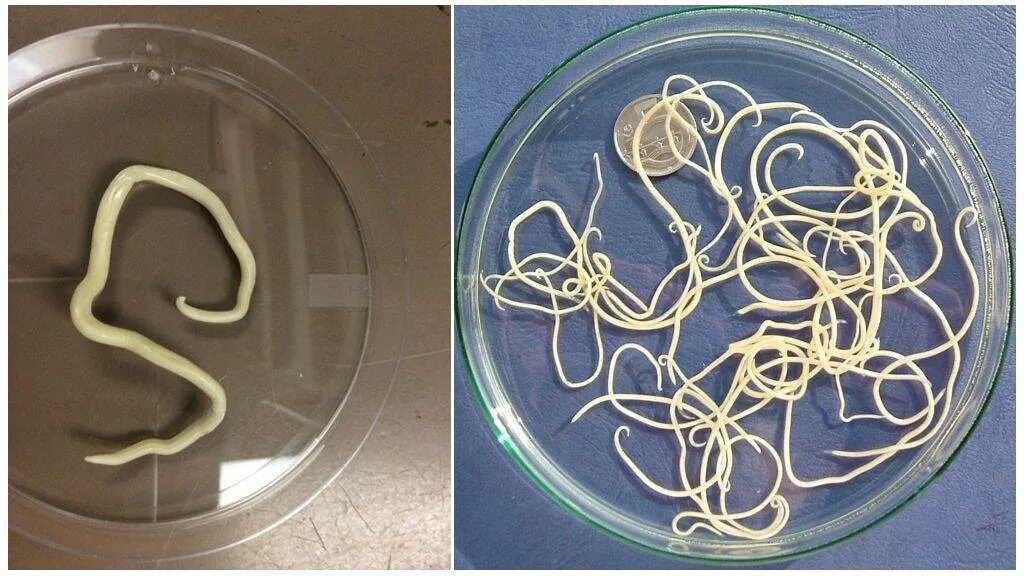 Покажи как выглядят глисты Какие цветом паразиты: найдено 90 изображений
