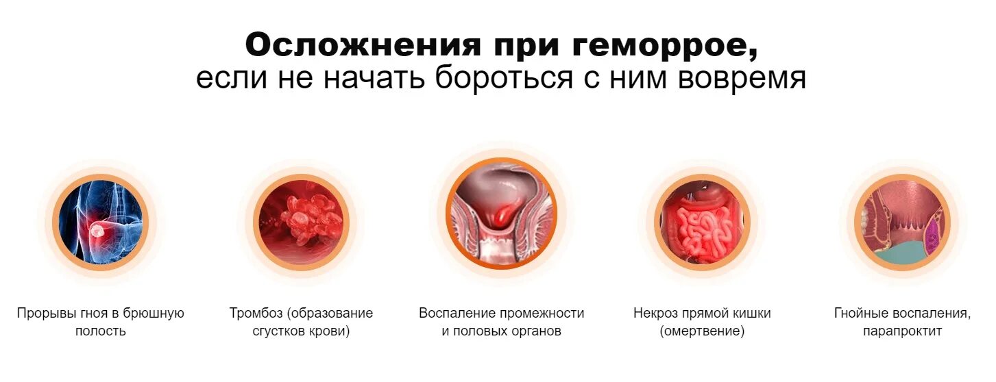 Покажи картинки как выглядит геморрой Геморрой с кровотечением карта вызова