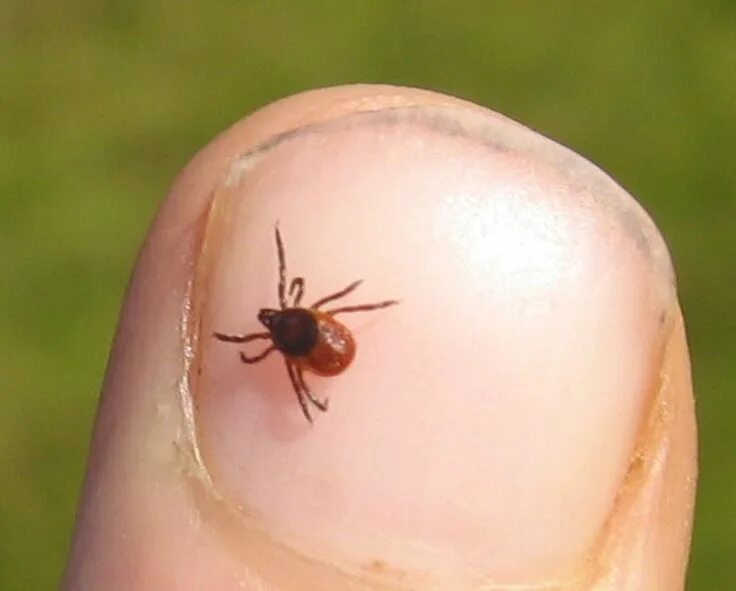 Покажи картинки как выглядит клещ Is that tick carrying a disease? A Pa. lab will test it for free Immuunsysteem, 