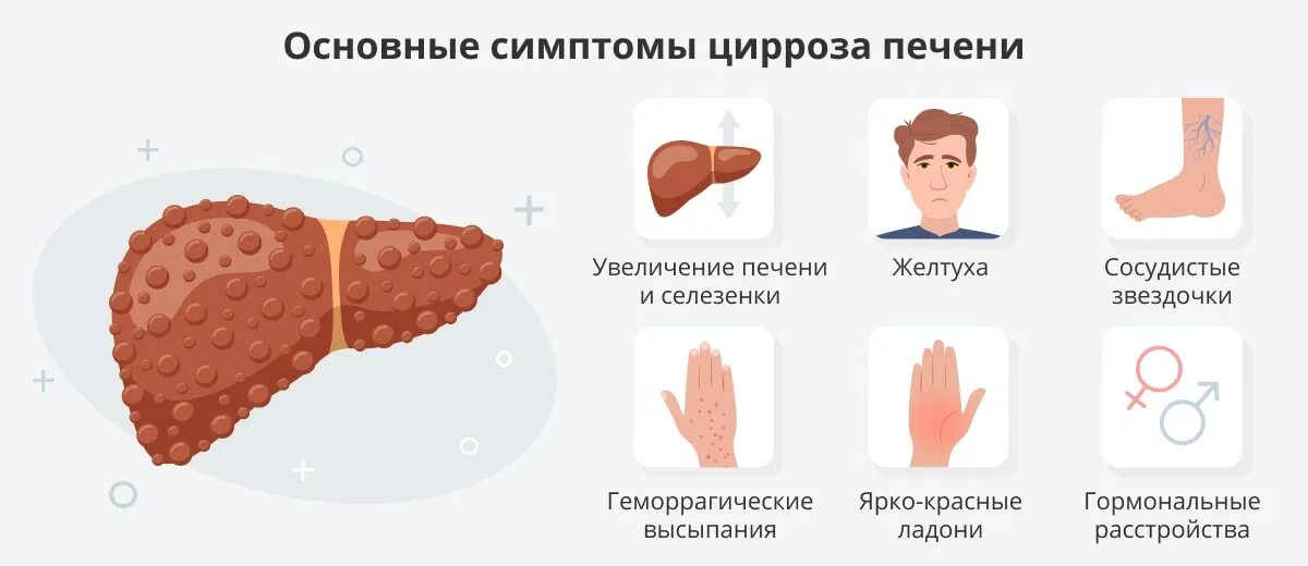 Покраснение ладоней при циррозе печени фото Цирроз печени: причины, признаки, симптомы и лечение