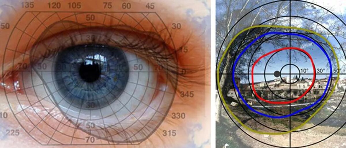 Поле зрения фото Что значит близорукость на одном из меридианов? - энциклопедия Ochkov.net