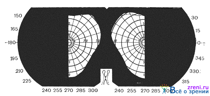 Поле зрения фото Изменения органа зрения при заболеваниях центральной нервной системы Часть 2.