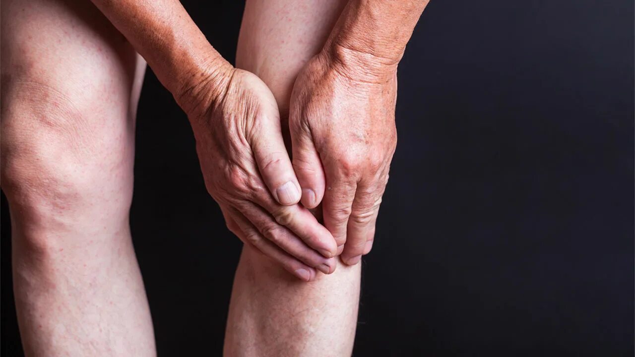 Полиартрит ног симптомы и лечение фото Knee arthritis in Americans has doubled since 1940 Science AAAS