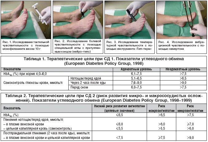 Полинейропатия нижних конечностей фото Диагностика и лечение диабетической дистальной полинейропатии у больных сахарным