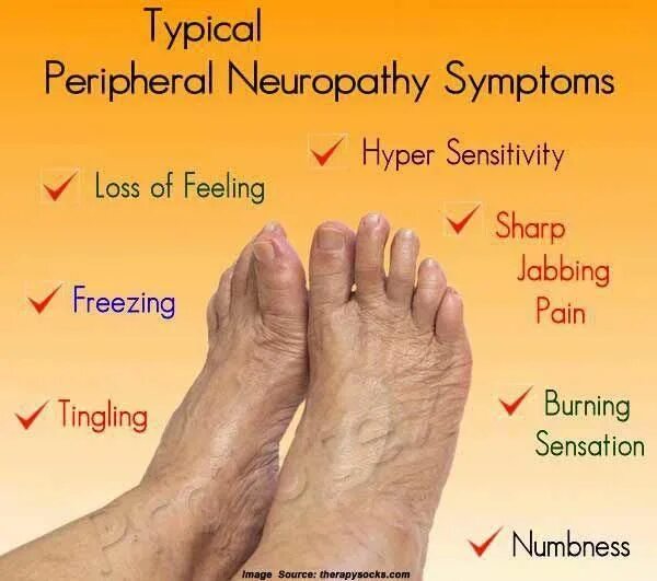 Полинейропатия нижних конечностей фото Signs and Symptoms Of Neuropathy #diabetesremede Symptoms of neuropathy, Periphe