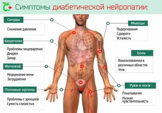 Полинейропатия симптомы фото Неврит большеберцового нерва: симптомы, лечение