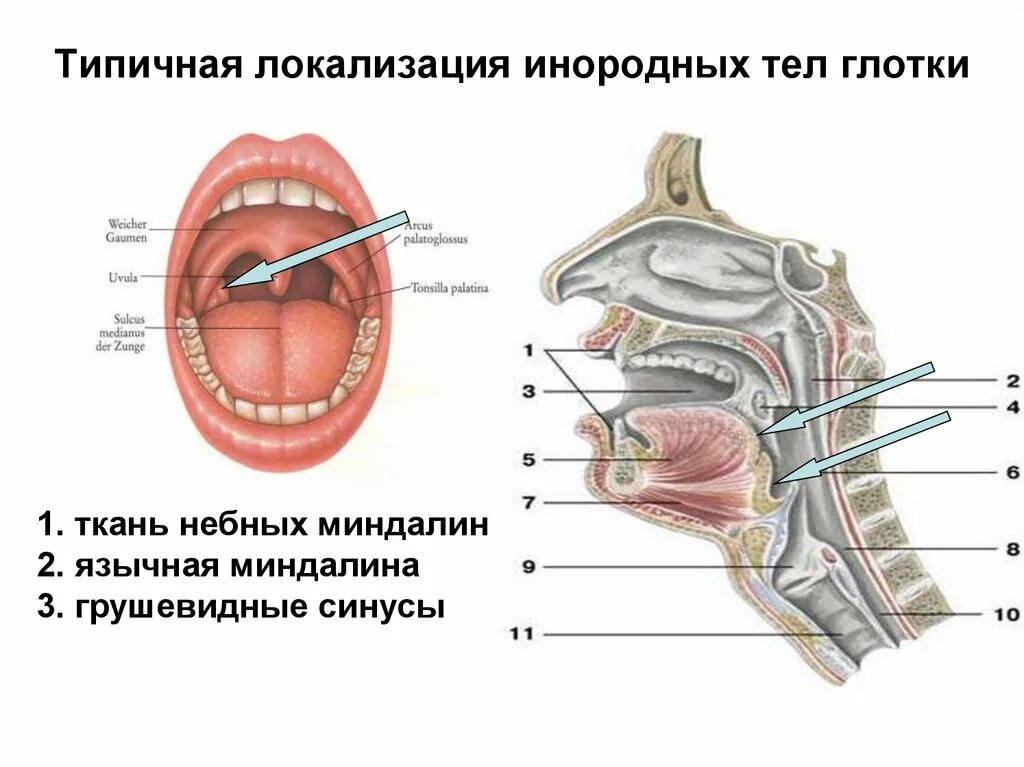 Полип на язычке в горле фото За языком что то есть: найдено 28 изображений