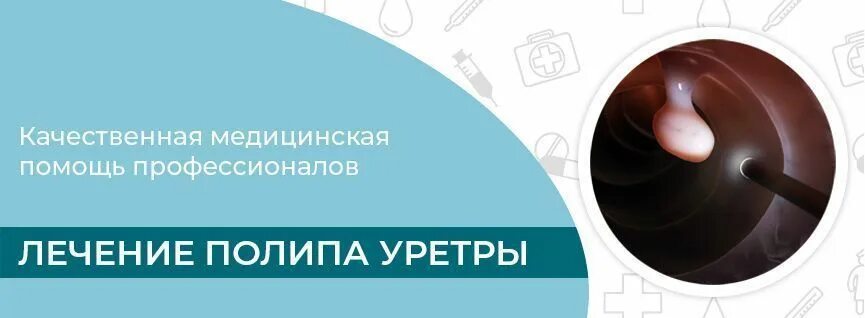 Полип уретры фото снаружи Лечение полипа уретры - Запись на прием онлайн в г. Сочи - клиника УРО-ПРО