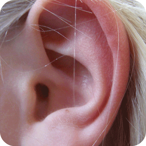 Полип в ухе фото Ear Infection Home Remedies - Apps on Google Play