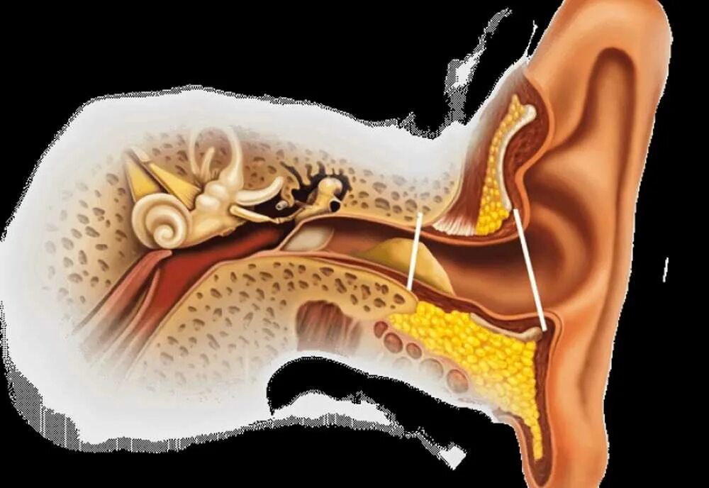 Полипы в ухе у человека фото Сера в ушах человека