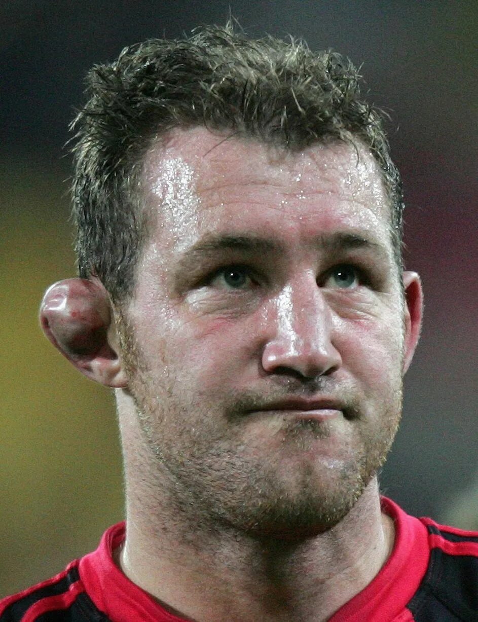 Поломанные уши фото The worst ears in rugby - Mirror Online