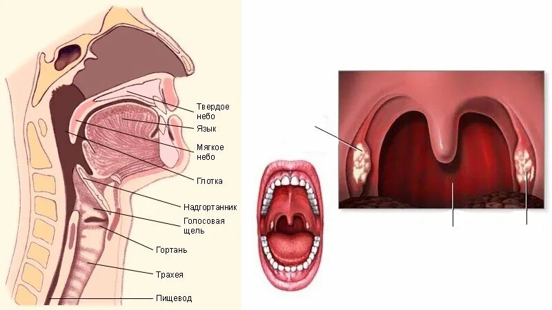 Полость горла фото Глотка лет