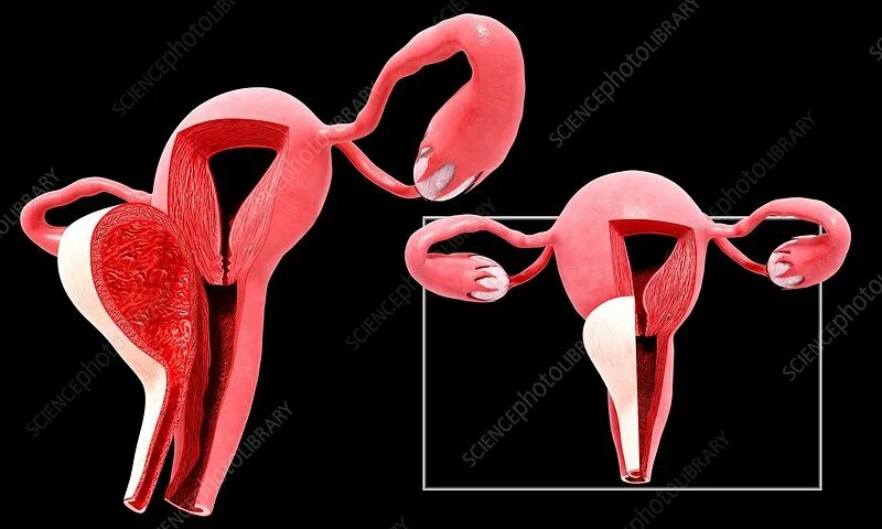 Половая система женщины фото Female reproductive system, artwork - Stock Image - F008/1117 - Science Photo Li