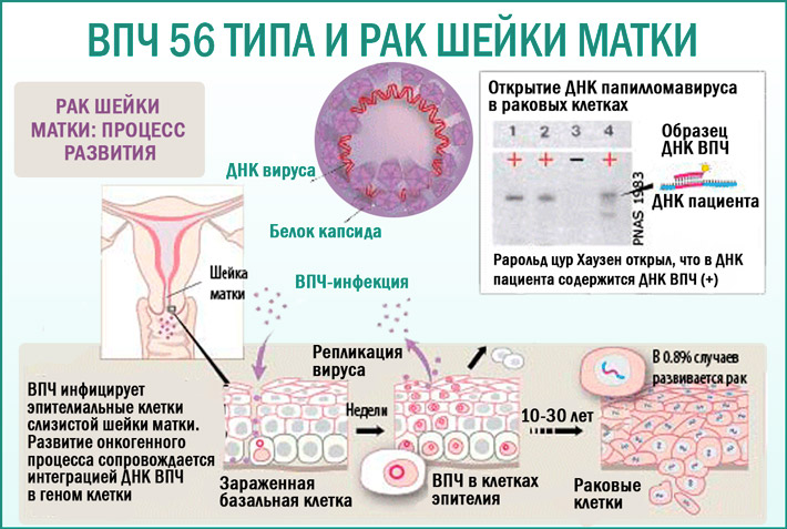 Половой генитальный герпес фото Днк вируса папилломы 39