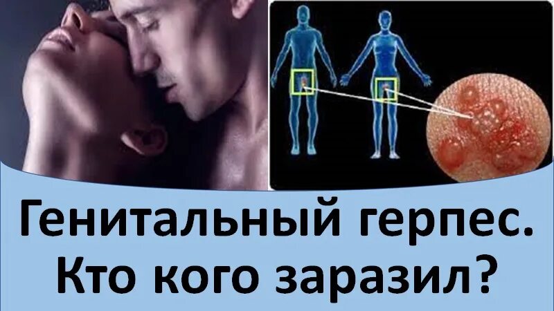 Половой герпес фото Генитальный герпес. Кто кого заразил. - смотреть видео онлайн от "Клиника Частна