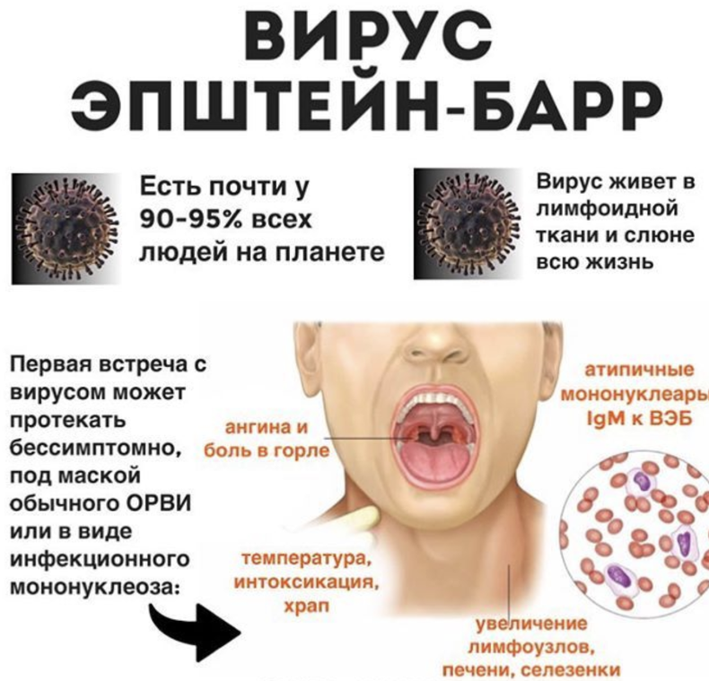 Половой герпес у детей фото Вирус Эпштейна–Барра: в чем опасность и как помочь организму