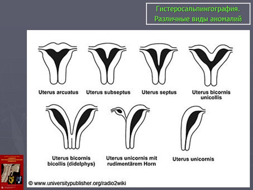 Половые губы щавель фото Виды женских половых губ щавель Shtampik.com