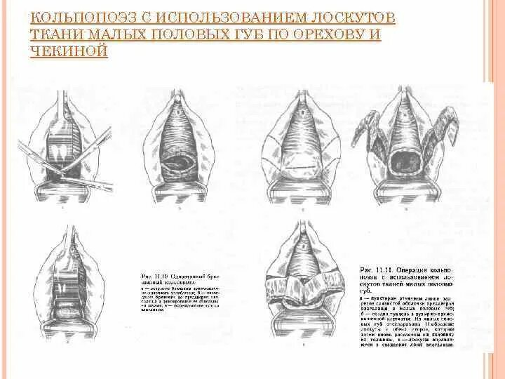 Половые губы щавель фото Нижняя половая губа больше