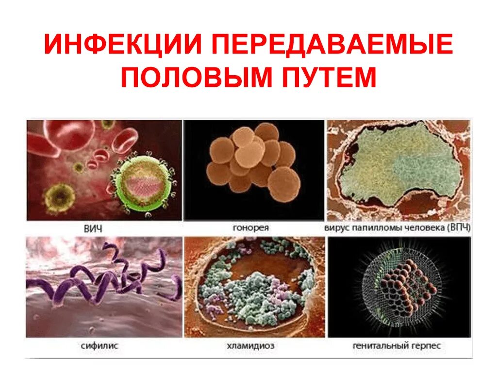 Половые инфекции у женщин симптомы фото Сдать анализы на ЗППП в Новороссийске, цены на комплексные анализы на ИППП недор