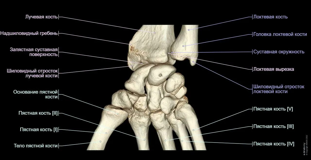 Полулунная кость фото Анатомия запястья (МРТ): нормальная анатомия e-Anatomy