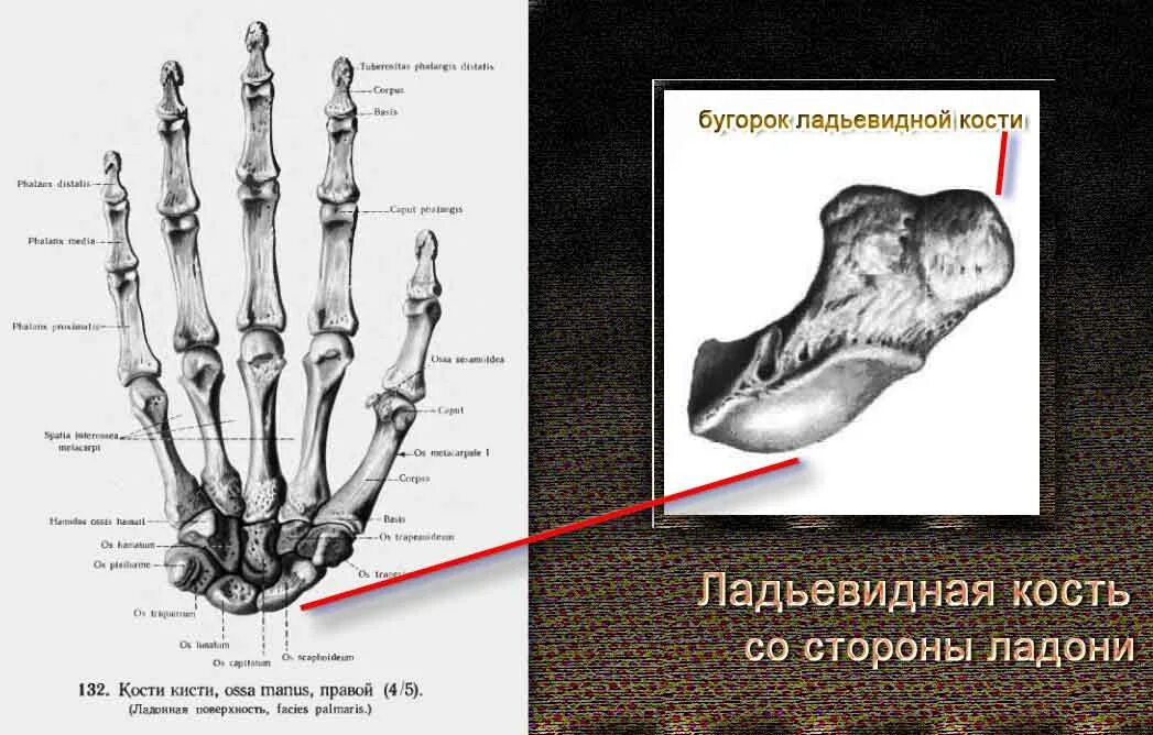 Полулунная кость кисти фото Ладьевидная кость, os scaphoideum. книга песка