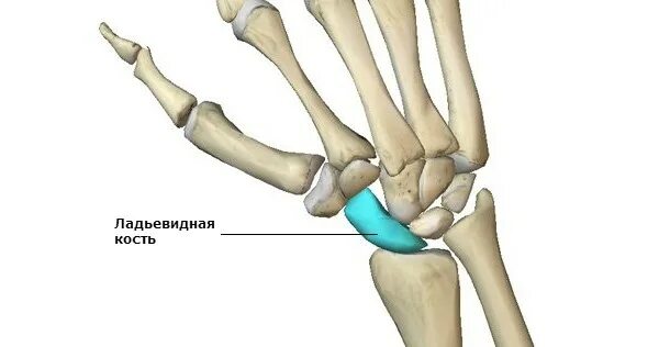Полулунная кость запястья фото Перелом ладьевидной кости кисти