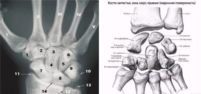 Полулунная кость запястья фото Считалка косточек. кто учился в меде тот поймет 2014 Массаж в Санкт-Петербурге С
