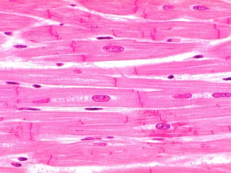 Поперечно полосатая мышечная ткань фото под микроскопом cardiac muscle tissue - Google Search Tissue biology, Cardiac muscle cell, Medic