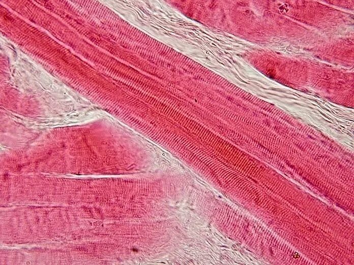 Поперечно полосатая мышечная ткань фото под микроскопом File:Skeletal muscle - longitudinal section.jpg - Wikipedia