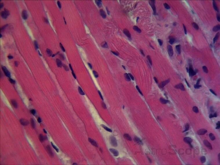 Поперечно полосатая мышечная ткань фото под микроскопом Статины и мышечные боли Кардиолог Константин Крулёв Дзен