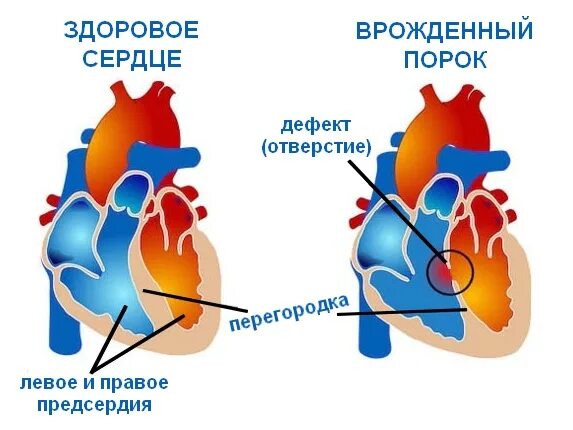 Пороги сердца фото Порок фото - Картины мира