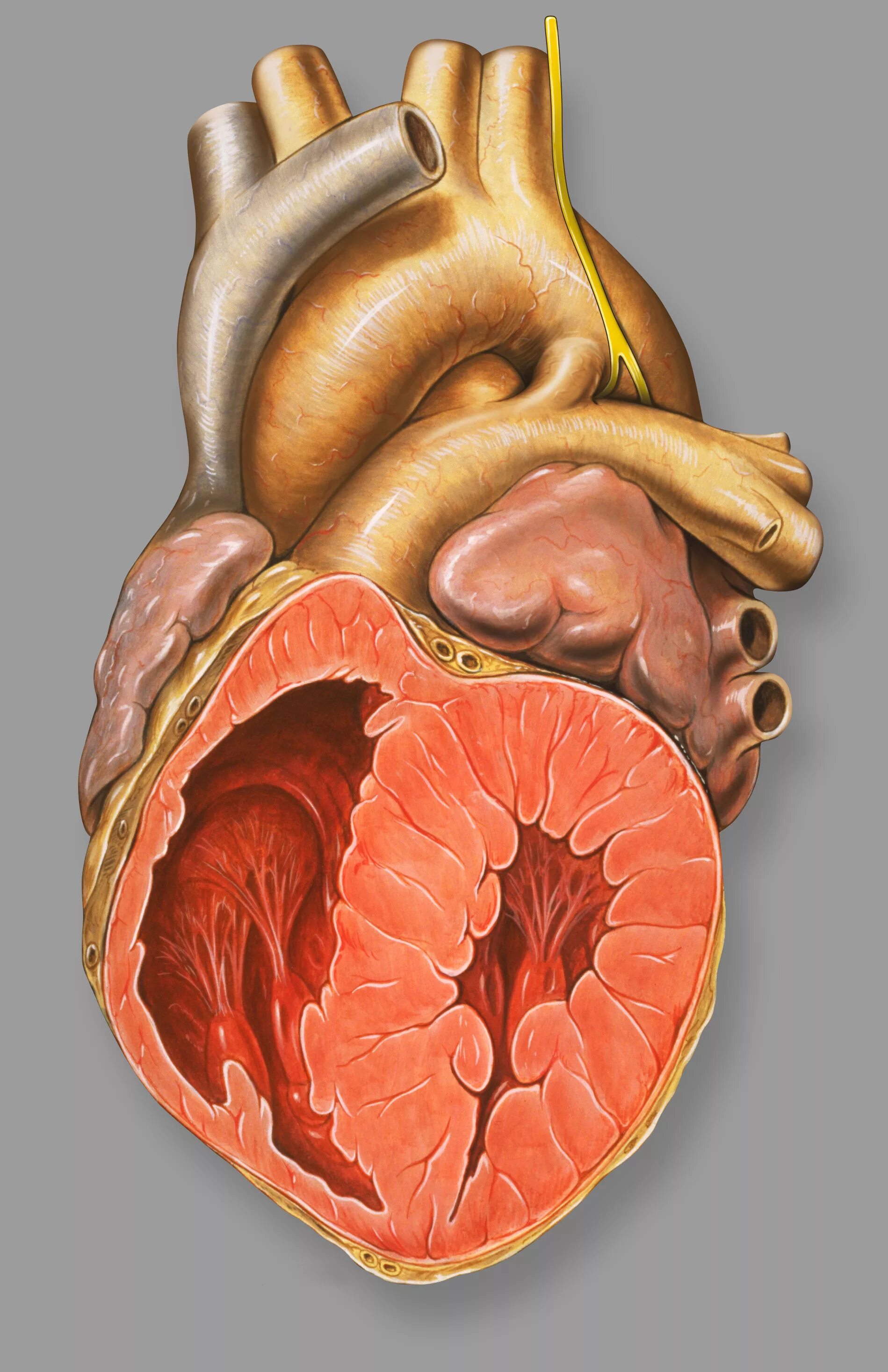 Пороги сердца фото Файл:Heart patent ductus arteriosus.jpg - Википедия