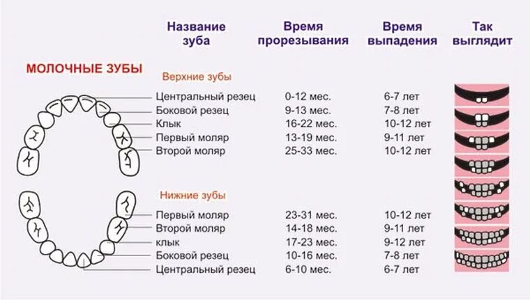 Порядок молочных зубов фото Порядок прорезывания зубов у детей. Режутся зубки: симптомы, признаки у грудничк