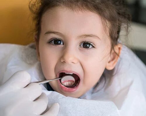 Посеребренные зубы у детей как выглядят Children’s Dentistry Center, TX Pediatric Dentist Dental Checkups