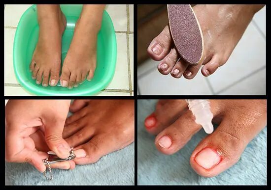 Пошаговая инструкция педикюра фото Pin on Beautiful Toenails Inspiration