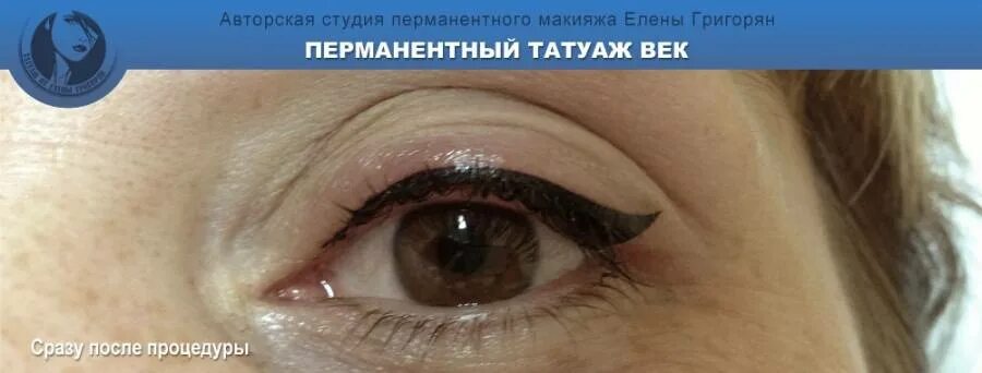 После татуажа век Татуаж век: последствия, которые можно ожидать