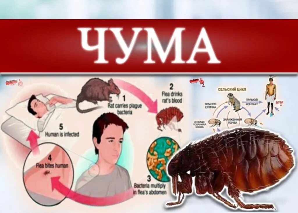 Последняя стадия чумы фото Природно-очаговые особо опасные инфекции (Чума.) Специалист по профилактике ЦГБ 