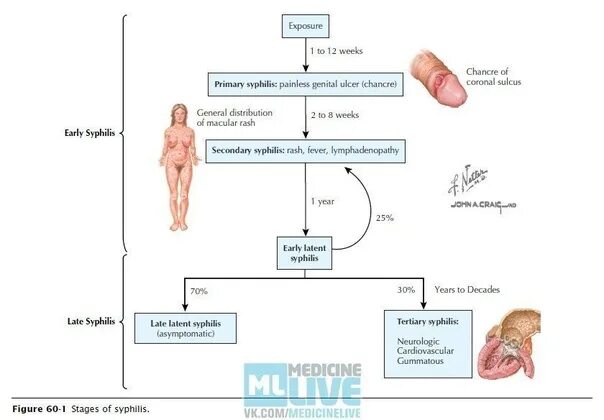 Последняя стадия сифилиса фото Stages of syphilis There are three main stages of syphilis, completely different