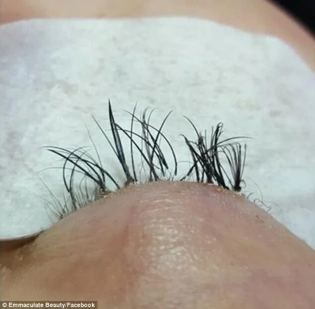 Последствия наращивания ресниц фото Beauty professional warning after eyelash extension job Daily Mail Online