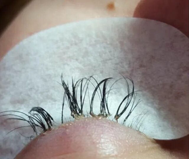 Последствия наращивания ресниц фото Beauty expert issues warning after woman’s eyelash extensions cause her real one