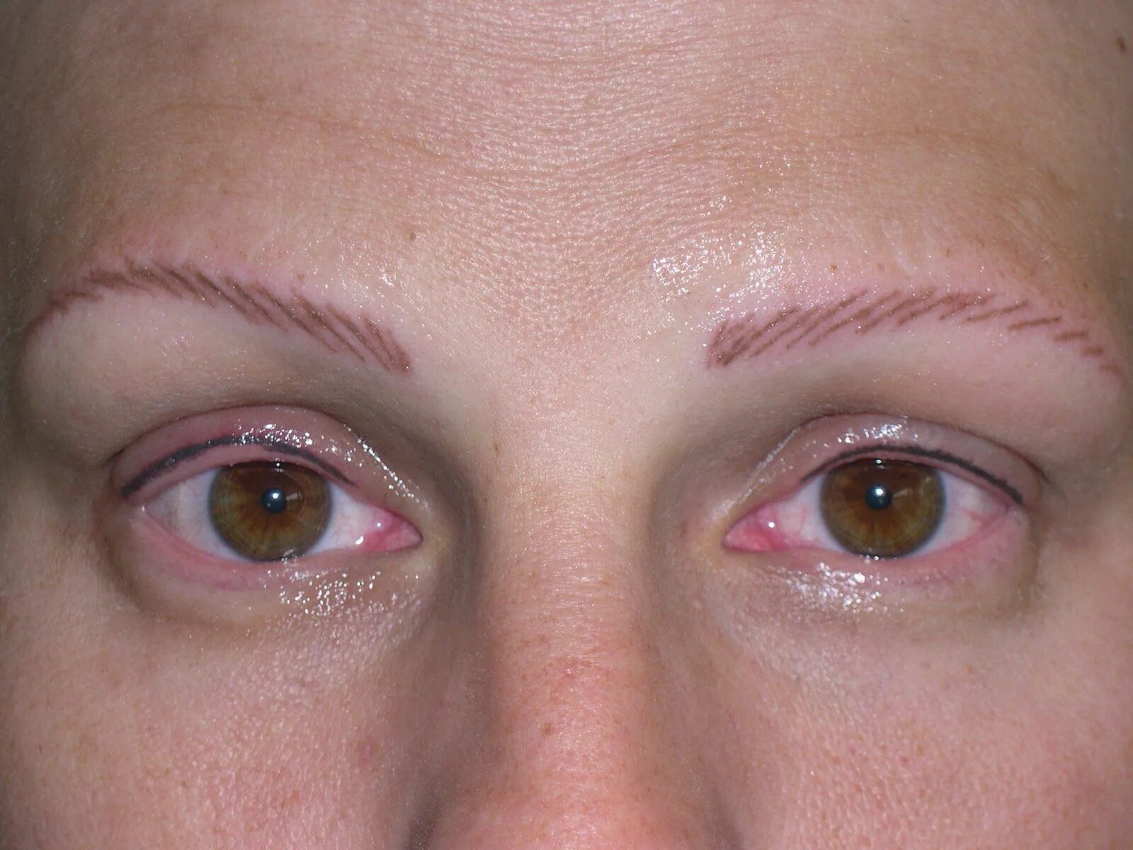 Последствия татуажа фото http://permanentmakeup2014.de/ und http://www.beautystudioveronika.de/ UNTERSCHÄ