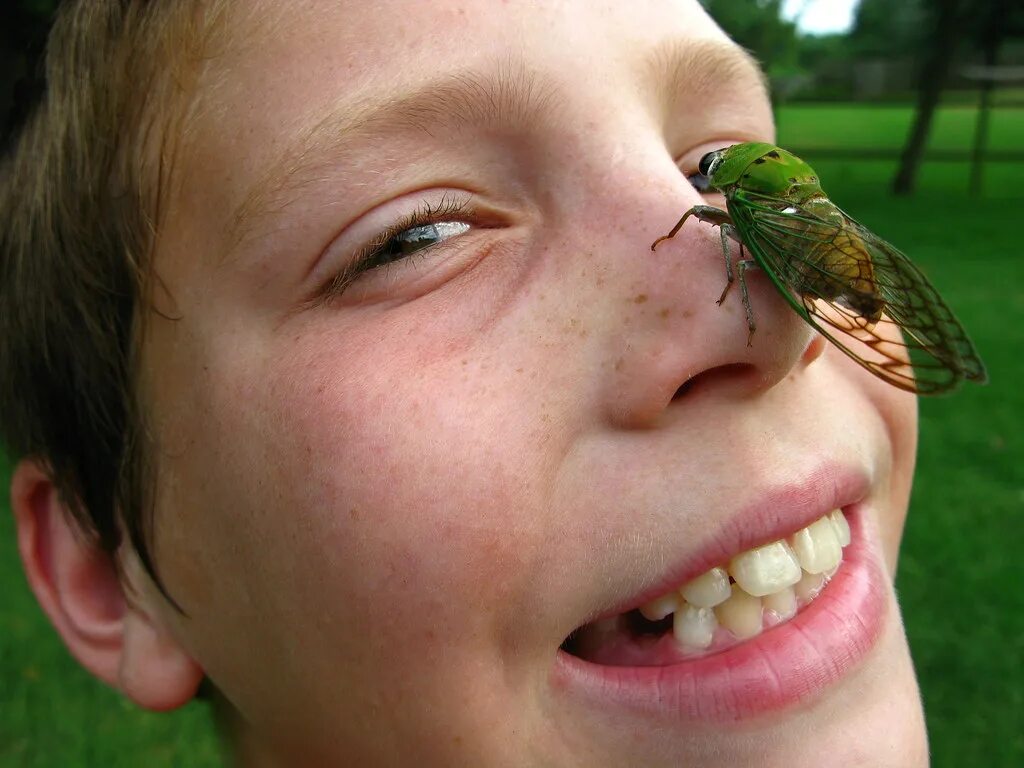 Последствия укуса насекомых фото Nosey Cicada While doing yardwork yesterday, we found one . Flickr