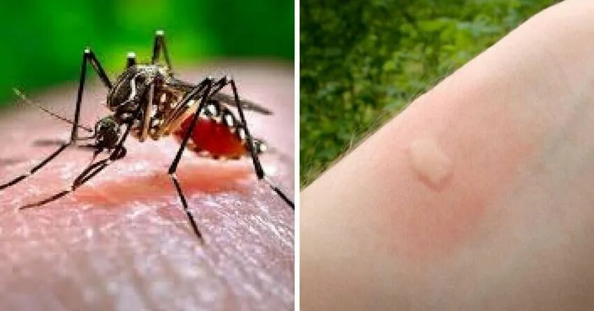 Последствия укусов клопов фото 12 Common Bug Bites And How To Recognize Each One in 2019 Ant bites, Spider bite