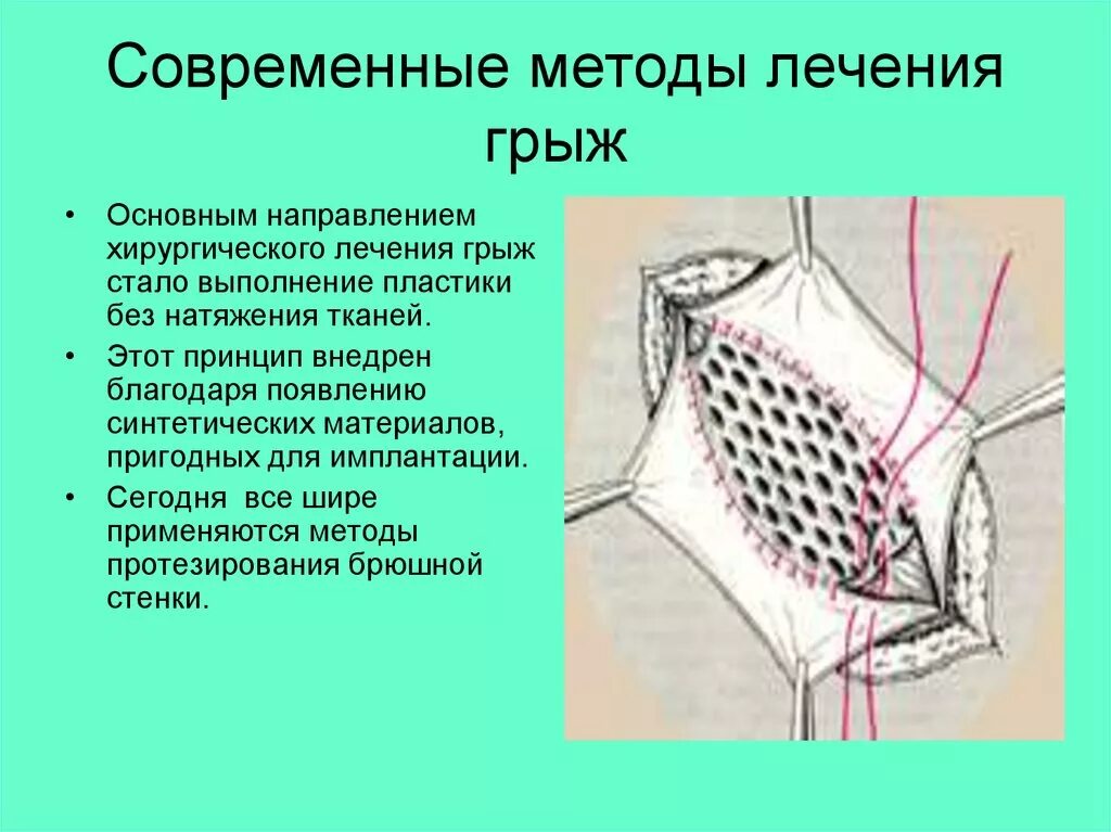 Диастаз прямых мышц живота, фоторезультаты и цены в Москве